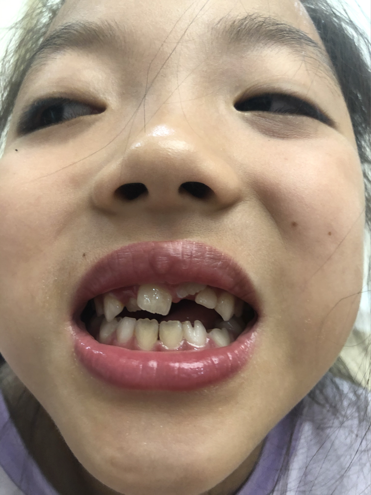 莊最新牙齒技術(shù)揭秘，牙齒美容新選擇
